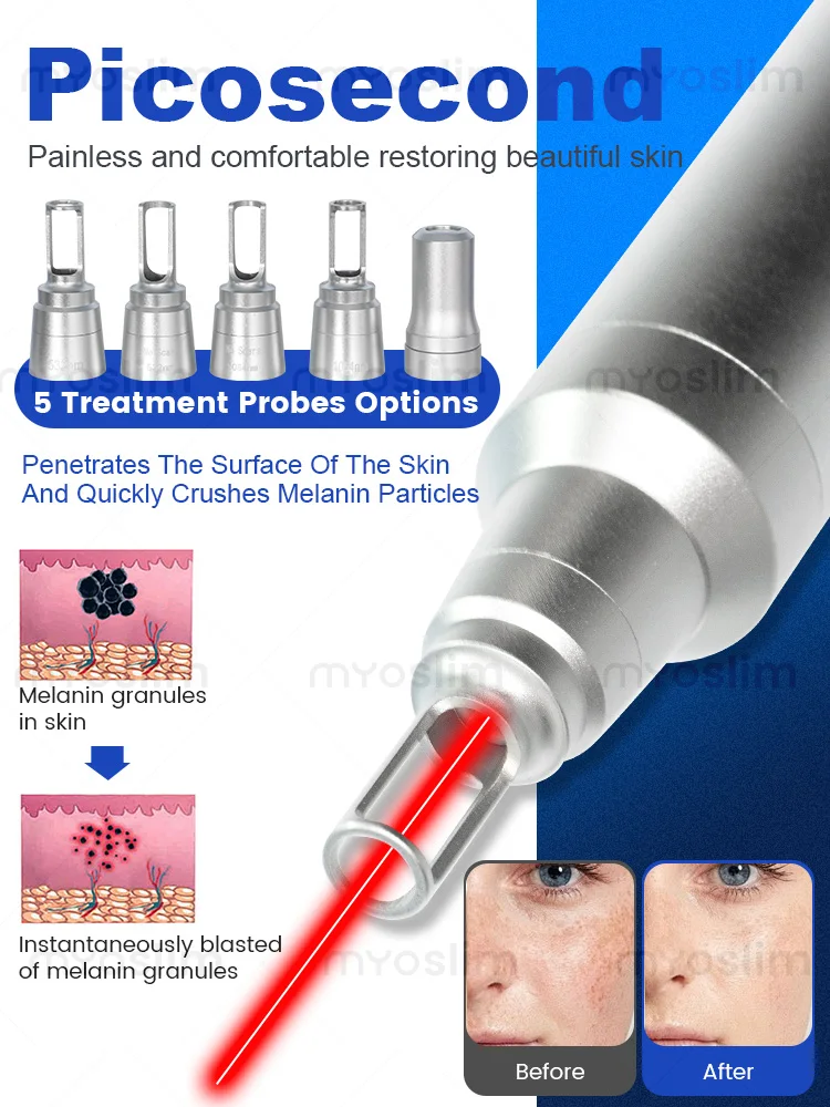 2 IN 1 Professional 4 Wave 5000W FAC 808 Diode Laser Permanent Painless Hair Removal Picosecond Laser ND YAG tattoo Removal
2 IN 1 Professional 4 Wave 5000W FAC 808 Diode Laser Permanent Painless Hair Removal Picosecond Laser ND YAG tattoo Removal