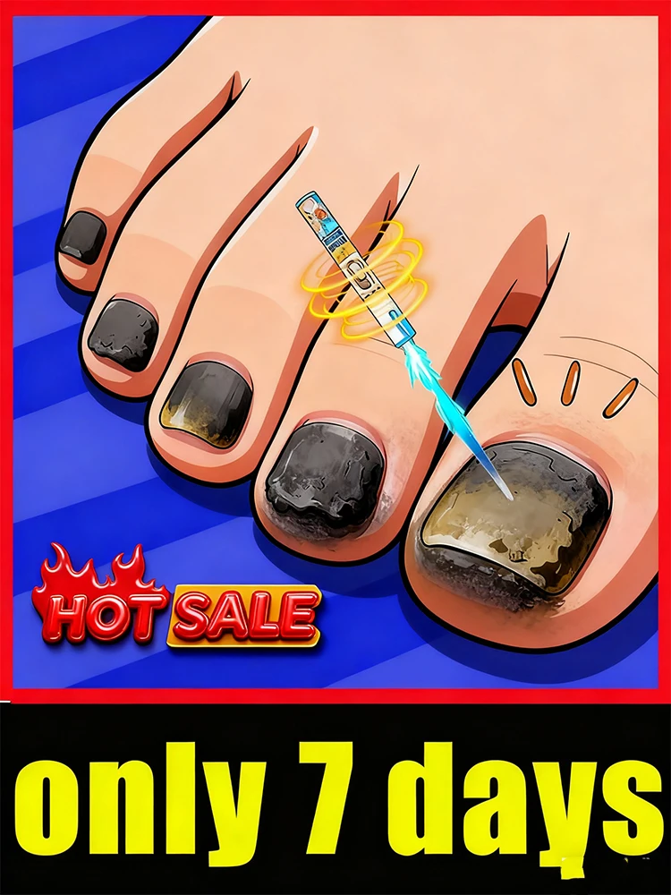 Возьмите уход за ногтями
Возьмите уход за ногтями