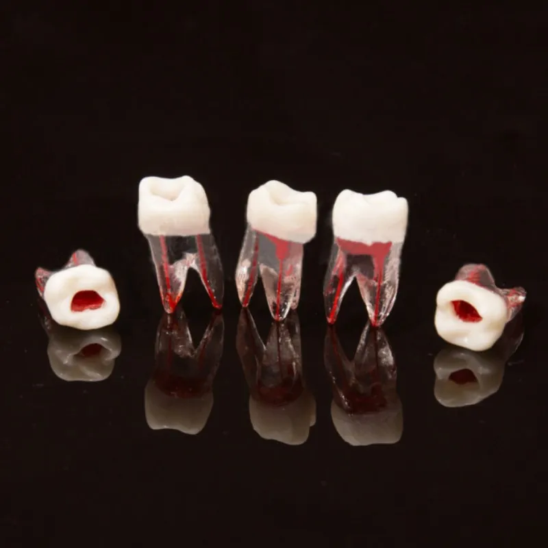 1pcs Dental Tooth Root Canal Model For RCT Practice Pulp Cavity Clear Resin Teaching Teeth Model 1:1 Dentistry Lab Tools
1pcs Dental Tooth Root Canal Model For RCT Practice Pulp Cavity Clear Resin Teaching Teeth Model 1:1 Dentistry Lab Tools