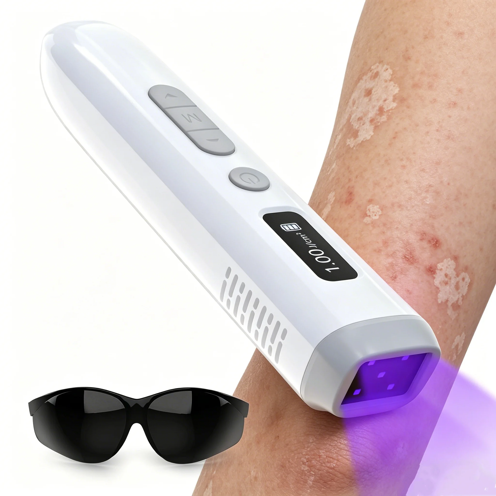 308nm UVB Vitiligo Lamp Handheld Narrow Spectrum Ultraviolet Light Therapy Device for Psoriasis Eczema Beauty Spot Care
308nm UVB Vitiligo Lamp Handheld Narrow Spectrum Ultraviolet Light Therapy Device for Psoriasis Eczema Beauty Spot Care