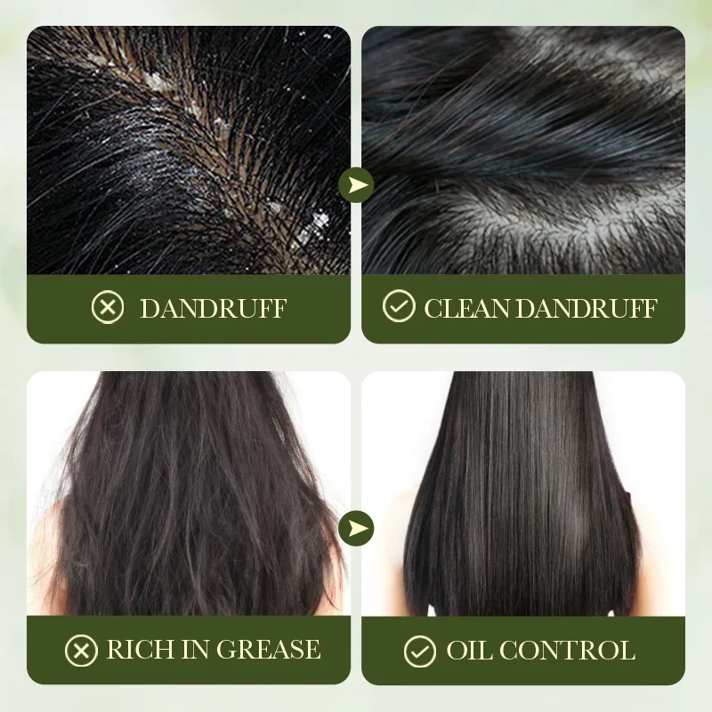 500ml SADOER Olive Oil Nourishing Anti-Dandruff Shampoo Long-Lasting Refresh Not Greasy Treatment Dandruff Hair Beauty Health
500ml SADOER Olive Oil Nourishing Anti-Dandruff Shampoo Long-Lasting Refresh Not Greasy Treatment Dandruff Hair Beauty Health