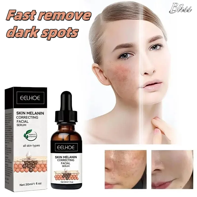 Melasma Correcting Serum Fade Dark Spots Brightening Moisturizing Nicotinamide Essence Lighten Face Improve Dullness Skin Care
Melasma Correcting Serum Fade Dark Spots Brightening Moisturizing Nicotinamide Essence Lighten Face Improve Dullness Skin Care
