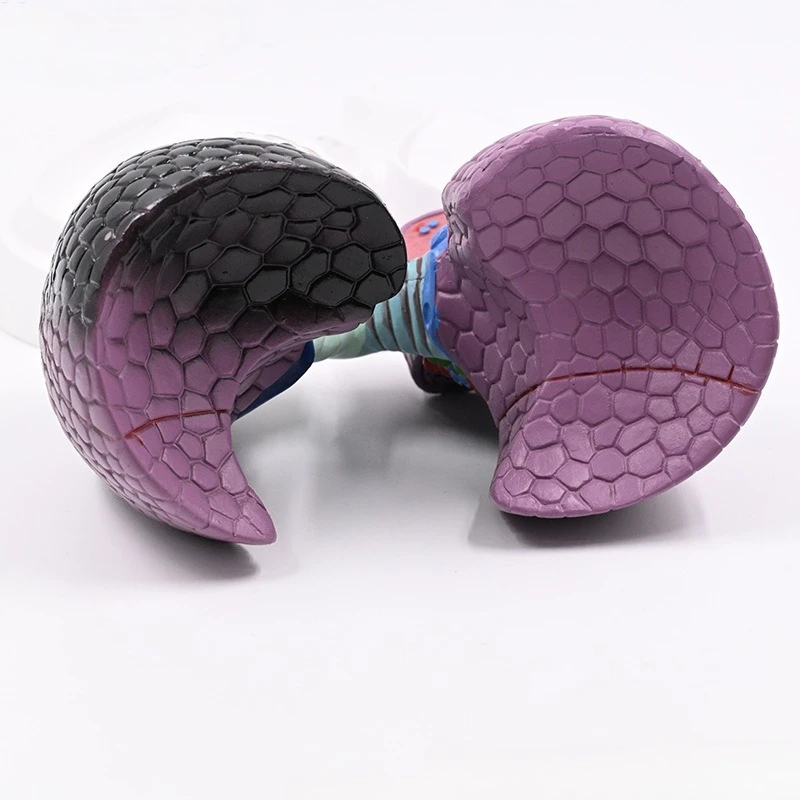 Human Lung Model, Smoking Lesion Lung Teaching Model