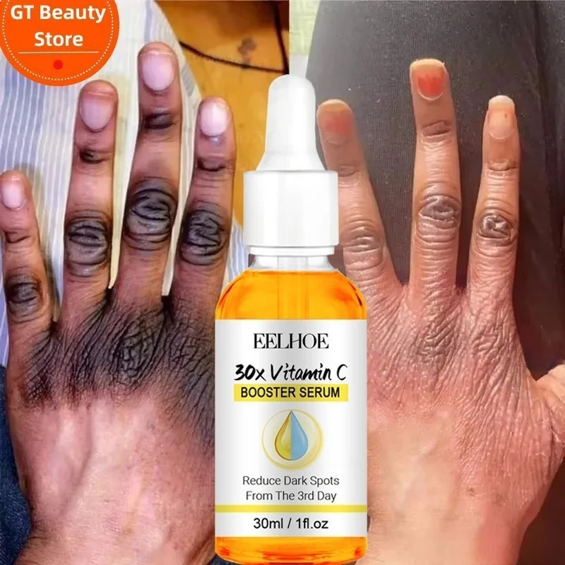 Dark knuckles fast brightness serum elbow manual knuckles brightness serum knee black skin fast brightness pigment removal
Dark knuckles fast brightness serum elbow manual knuckles brightness serum knee black skin fast brightness pigment removal