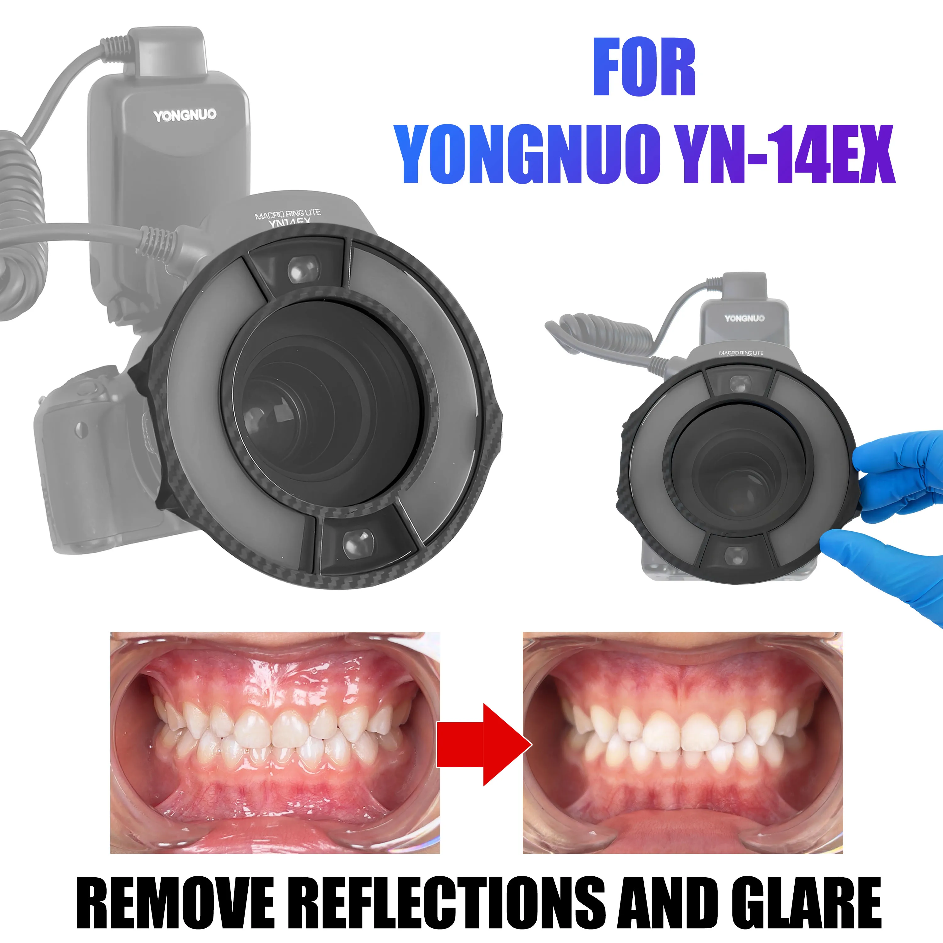 Cross Polarizing Lens for YONGNUO YN-14EX Filter for Dental Photos, Dental Photography Polar Eye Photos, No Glare, No Relfection
Cross Polarizing Lens for YONGNUO YN-14EX Filter for Dental Photos, Dental Photography Polar Eye Photos, No Glare, No Relfection
