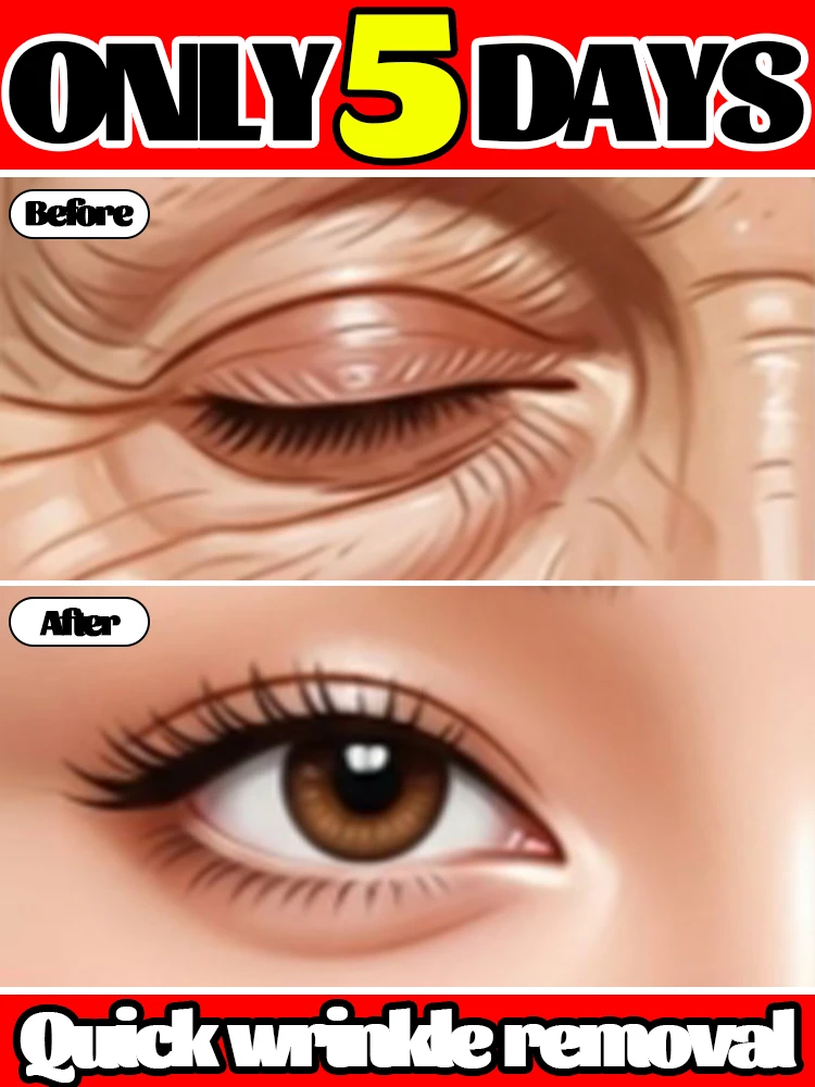 Инструменты для макияжа глаз 2025 года для уменьшения морщин
Инструменты для макияжа глаз 2025 года для уменьшения морщин