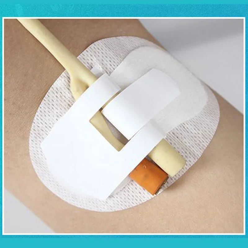 10Pcs Catheter Fixation Stickers Non-woven Adhesive Holder Bands for Urine Bag Leg Tube Fixed
10Pcs Catheter Fixation Stickers Non-woven Adhesive Holder Bands for Urine Bag Leg Tube Fixed