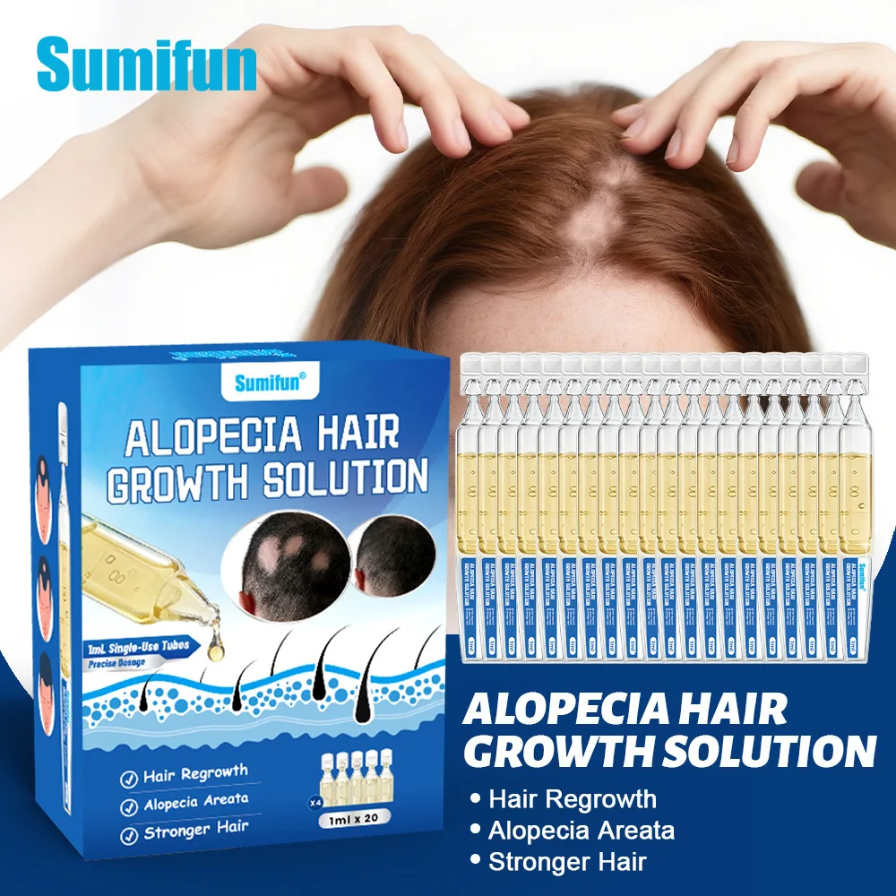 5/10/20-use Disposable Patchy Baldness Hair Growth And Hair Care Scalp Nourishing Cream
5/10/20-use Disposable Patchy Baldness Hair Growth And Hair Care Scalp Nourishing Cream