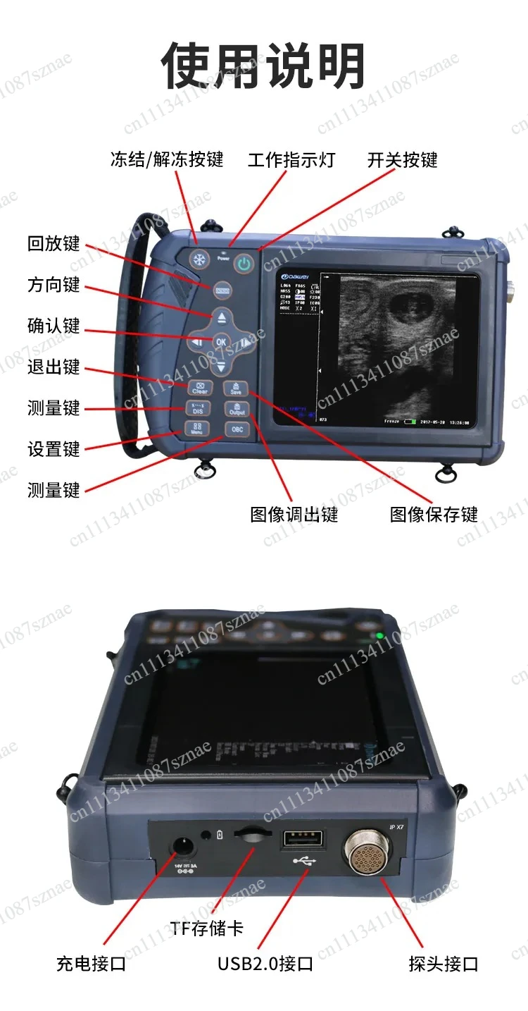 Handheld Bovine Ultrasound System with Rectal Linear Transducer, Portable Livestock Scanner for Cattle and Cow
Handheld Bovine Ultrasound System with Rectal Linear Transducer, Portable Livestock Scanner for Cattle and Cow