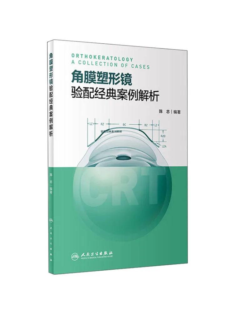 Book-Winshare Analysis классического случая угловой пленки, формирующего зеркального фитинга
Book-Winshare Analysis классического случая угловой пленки, формирующего зеркального фитинга