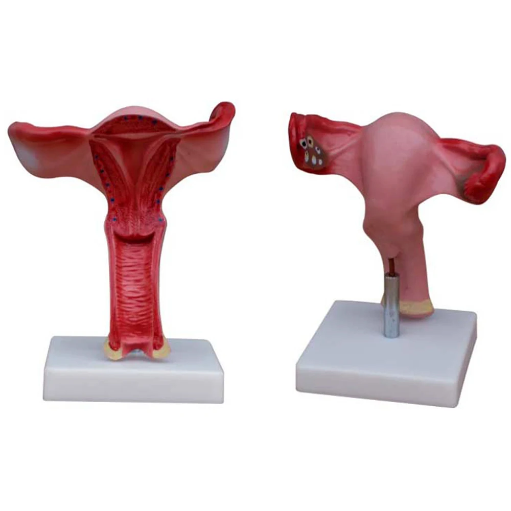 Anatomical Uterus Model, Ovarian Uterine Anatomy, Female Internal Reproductive Demonstration Teaching Tool
Anatomical Uterus Model, Ovarian Uterine Anatomy, Female Internal Reproductive Demonstration Teaching Tool