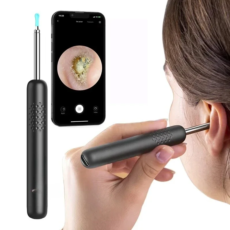 Vision Ear Cleaner for Ear Health Earwax Removal Device
Vision Ear Cleaner for Ear Health Earwax Removal Device
