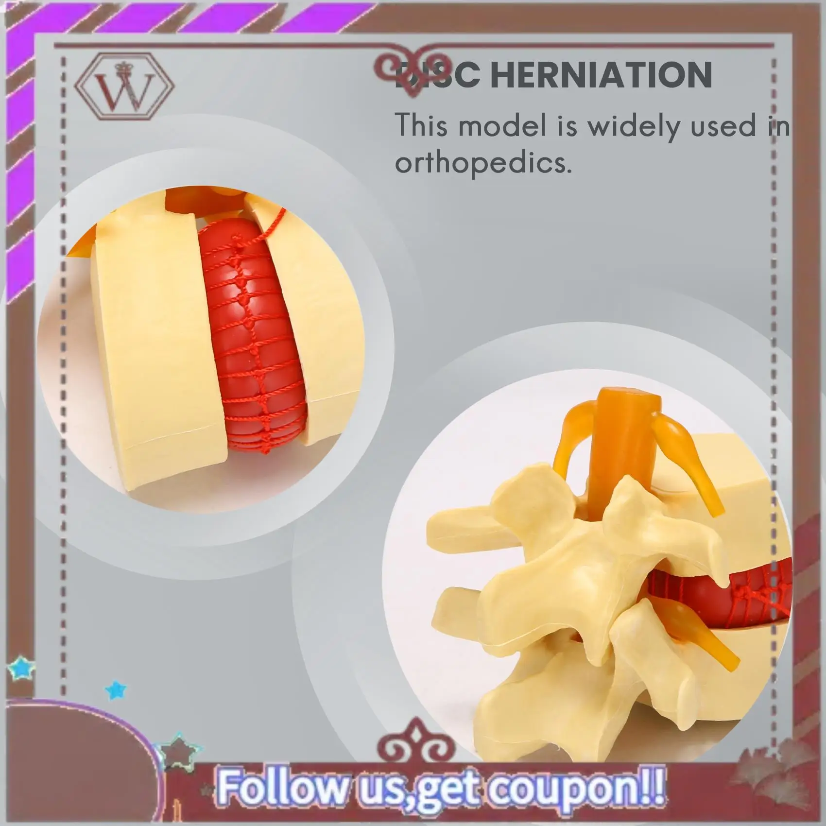 ABBG-Lumbar Vertebrae Model Anatomical Spine Lumbar Disc Herniation Anatomy Teaching Tool Lumbar Vertebrae Model
ABBG-Lumbar Vertebrae Model Anatomical Spine Lumbar Disc Herniation Anatomy Teaching Tool Lumbar Vertebrae Model