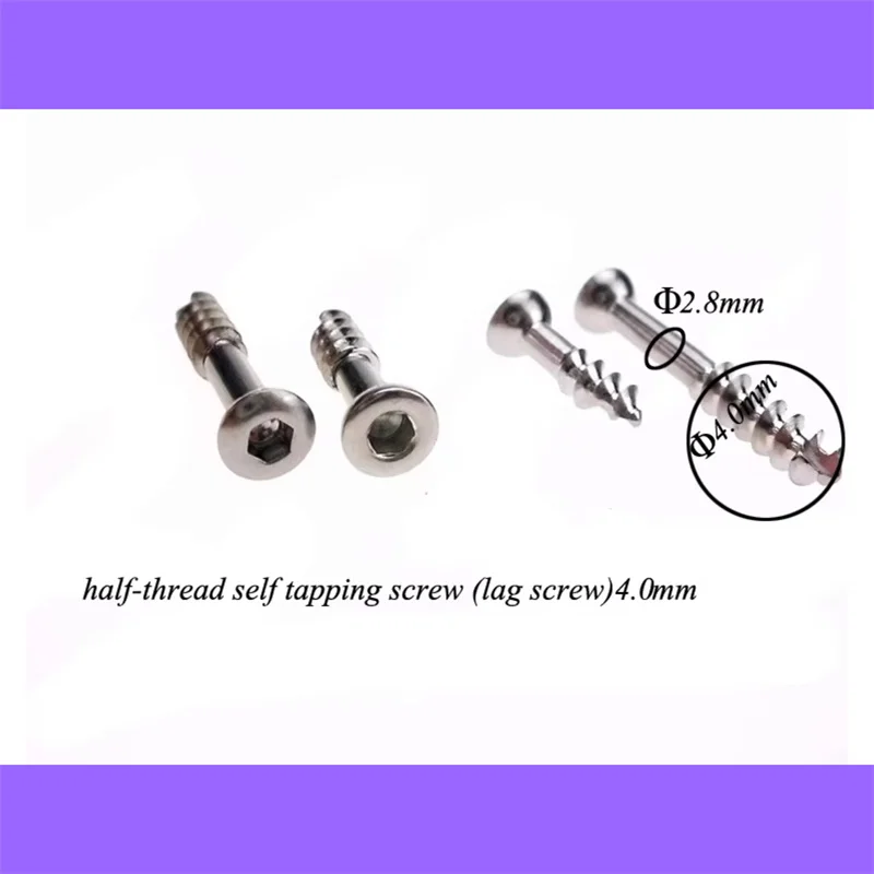 Orthopedic instrument cancellous screw 4.0mm self tapping stainless steel Hex screw 10pcs/pack lag screw for VET&orthopedist
Orthopedic instrument cancellous screw 4.0mm self tapping stainless steel Hex screw 10pcs/pack lag screw for VET&orthopedist