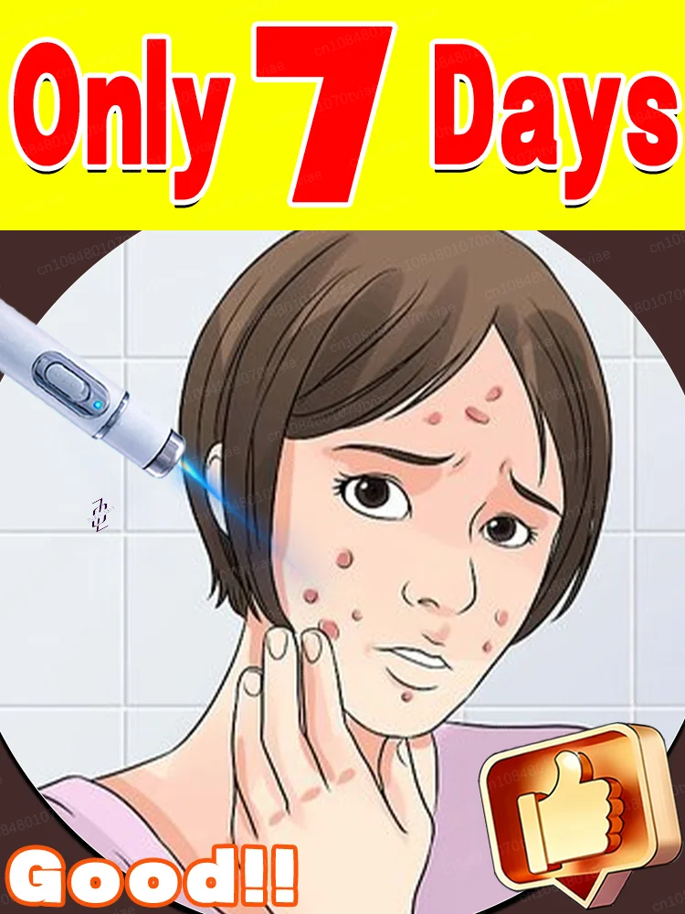 2025 Wart Removal Pen - Safe and Effective, Warts Fall Off Automatically
2025 Wart Removal Pen - Safe and Effective, Warts Fall Off Automatically