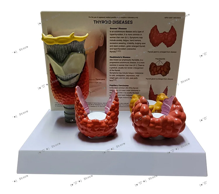 Thyroid Anatomical Model Thyroid Nodule Papillary Carcinoma Hashimoto's Thyroiditis Goiter Human Medicine
Thyroid Anatomical Model Thyroid Nodule Papillary Carcinoma Hashimoto's Thyroiditis Goiter Human Medicine
