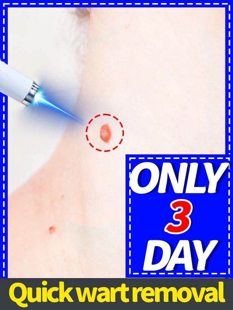 Third-generation laser treatment: say goodbye to ʷᵃʳᵗˢ in 3 days
Third-generation laser treatment: say goodbye to ʷᵃʳᵗˢ in 3 days
