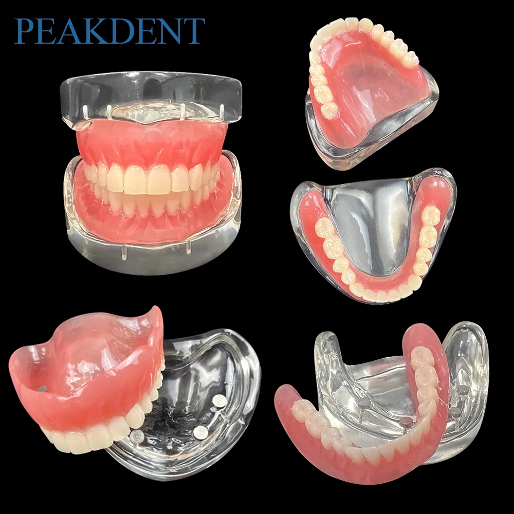 Dental Implant Model with 4 Implants Research Overdenture Restoration Upper Lower Teeth Model For Dentist Teaching training Demo
Dental Implant Model with 4 Implants Research Overdenture Restoration Upper Lower Teeth Model For Dentist Teaching training Demo