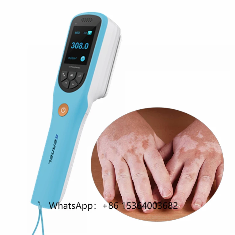 Kernel CN-308B Portable Psoriasis Vitiligo Treatment Lamp Uv 311nm Excimer Laser 308nm Uvb Led Phototherapy
Kernel CN-308B Portable Psoriasis Vitiligo Treatment Lamp Uv 311nm Excimer Laser 308nm Uvb Led Phototherapy