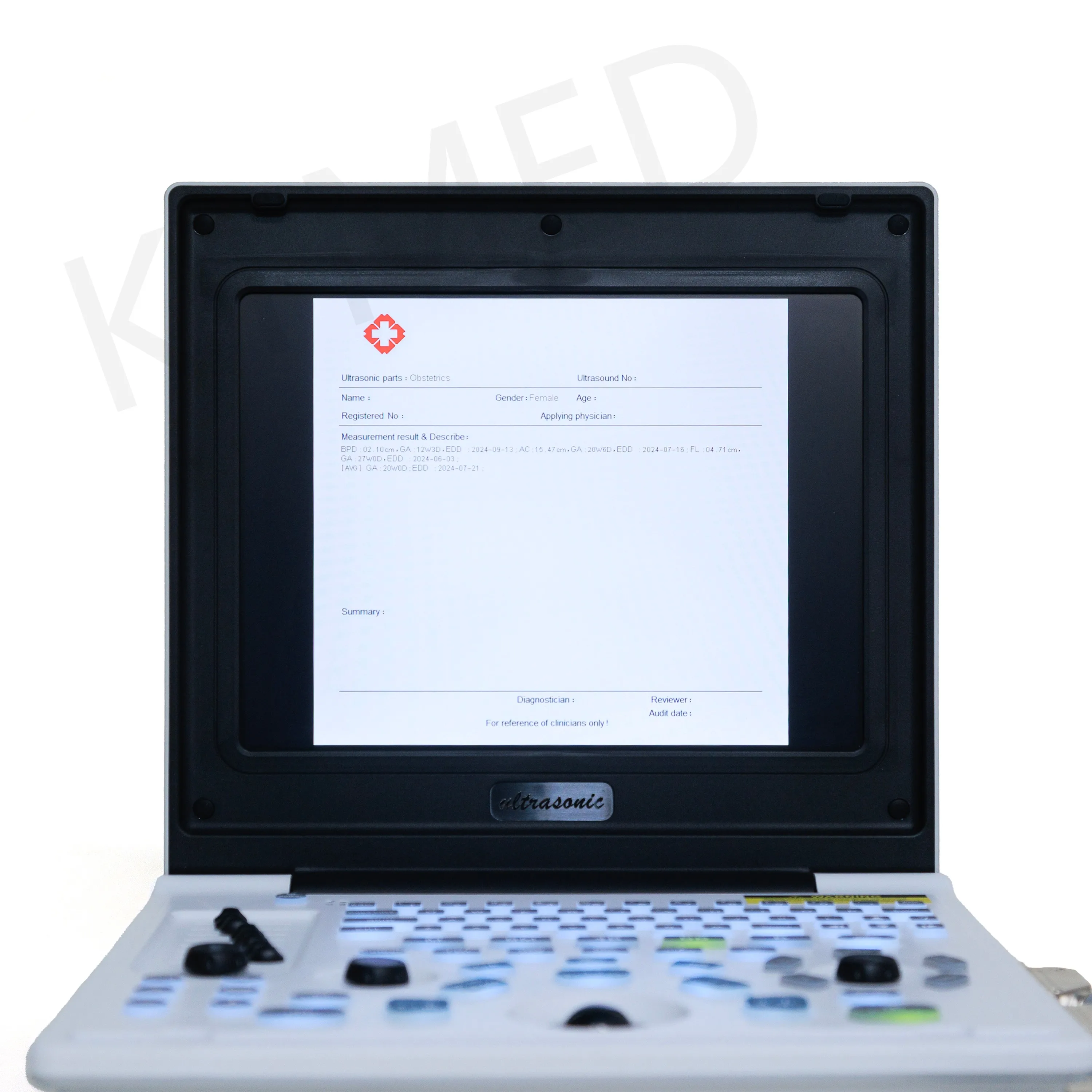 Portable Functional BW Scanner For Human And Vet KT-A026 Medical Laptop Digital Echocardiography
Portable Functional BW Scanner For Human And Vet KT-A026 Medical Laptop Digital Echocardiography
