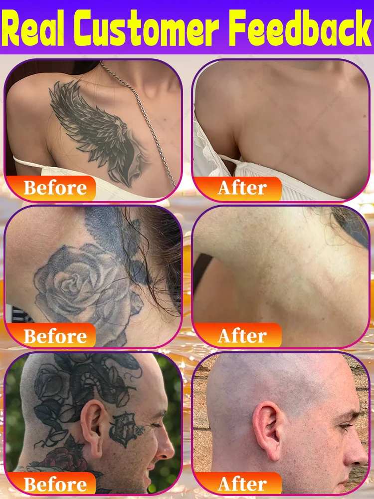 Oɪʟ Dʀᴀɪɴᴀɢᴇ Fᴀᴛ Bᴜʀɴɪɴɢ Sʟɪᴍᴍɪɴɢ Pᴀᴛᴄʜ ғᴏʀ Fᴀsᴛ Fᴀᴛ Lᴏss, Sᴛᴏᴘ ᴄᴇʟʟᴜʟɪᴛᴇ ғʀᴏᴍ ɢᴇᴛᴛɪɴɢ ғᴀᴛ.
Oɪʟ Dʀᴀɪɴᴀɢᴇ Fᴀᴛ Bᴜʀɴɪɴɢ Sʟɪᴍᴍɪɴɢ Pᴀᴛᴄʜ ғᴏʀ Fᴀsᴛ Fᴀᴛ Lᴏss, Sᴛᴏᴘ ᴄᴇʟʟᴜʟɪᴛᴇ ғʀᴏᴍ ɢᴇᴛᴛɪɴɢ ғᴀᴛ.