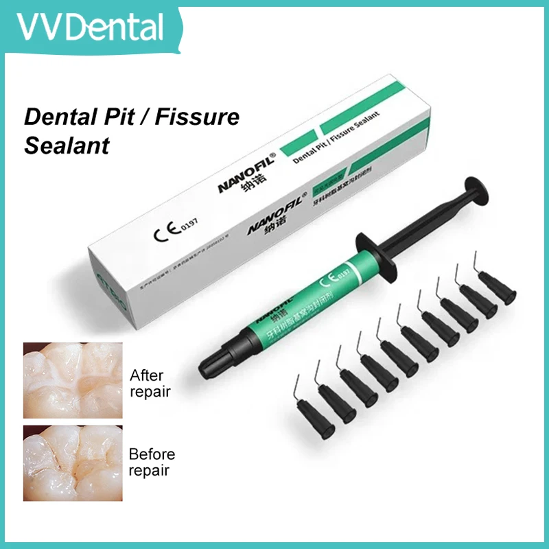 Dental Pit /Fissure Sealant for Tooth Prevent Caries Dental Composite Dental Pit and Fissure Material Dentistry Tool
Dental Pit /Fissure Sealant for Tooth Prevent Caries Dental Composite Dental Pit and Fissure Material Dentistry Tool