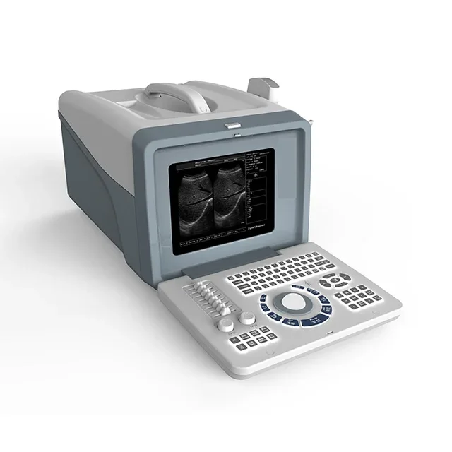 Portable Veterinary Ultrasound for Animal Clinic Handheld Ultrasound Machine Pet Ultrasound Machine
Portable Veterinary Ultrasound for Animal Clinic Handheld Ultrasound Machine Pet Ultrasound Machine
