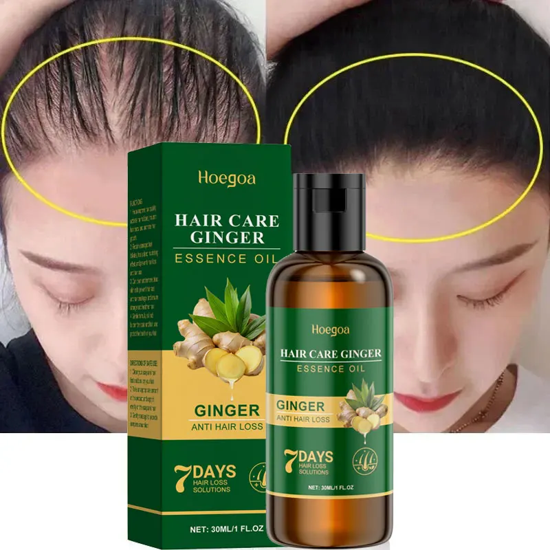 5-дневное эфирное масло для быстрого роста волос с имбирем, эффективная сыворотка против выпадения волос, предотвращающая облысение, уход за кожей головы для мужчин и женщин
5-дневное эфирное масло для быстрого роста волос с имбирем, эффективная сыворотка против выпадения волос, предотвращающая облысение, уход за кожей головы для мужчин и женщин