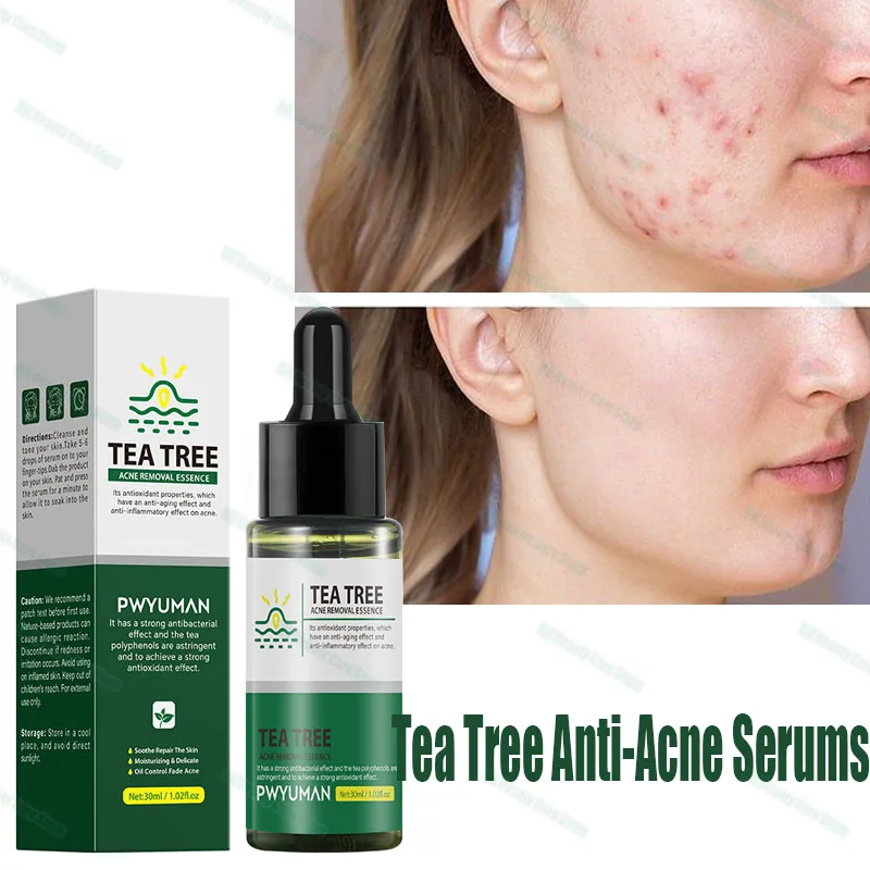 Tea Tree Anti-Acne Serums Improve Acne Marks Remove Scar Strengthen Skin Barrier Oil Control Shrink Pore Moisturizing Skin Care
Tea Tree Anti-Acne Serums Improve Acne Marks Remove Scar Strengthen Skin Barrier Oil Control Shrink Pore Moisturizing Skin Care