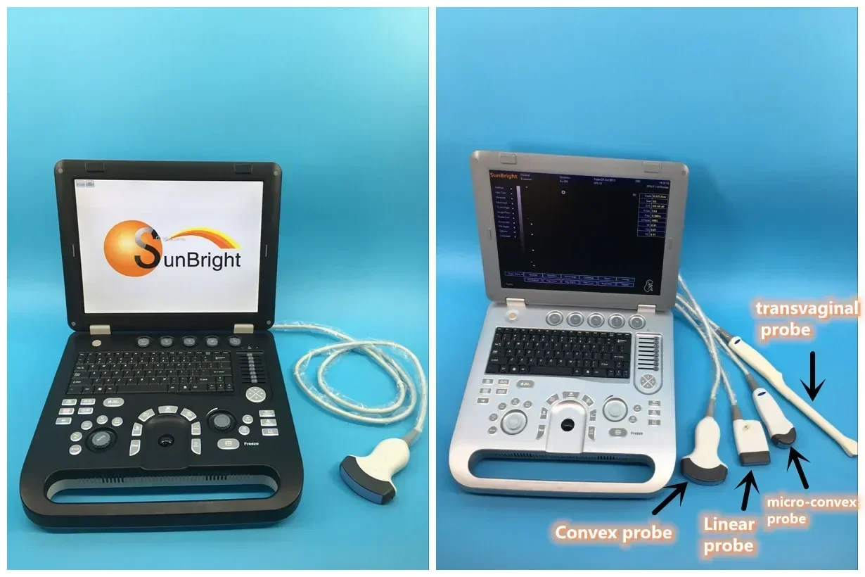 2026/2026/Professional Portable 3D Color display black and white ecografo Machine for
2026/2026/Professional Portable 3D Color display black and white ecografo Machine for