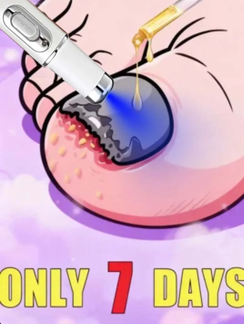 New Generation-2 Laser Says Goodbye To Bad Manicure in 7 Days
New Generation-2 Laser Says Goodbye To Bad Manicure in 7 Days