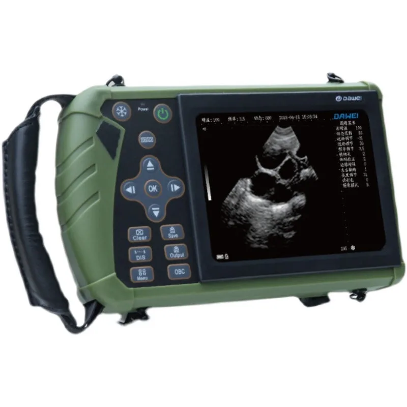 Low Price Hot Sale Portable Veterinary Animal Pregnancy Tester Ultrasound Machine for Cattle Cow Pig Sheep
Low Price Hot Sale Portable Veterinary Animal Pregnancy Tester Ultrasound Machine for Cattle Cow Pig Sheep