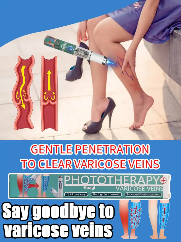 Support Circulation for Vein Health, Strength, and Function | Reduces Spider Veins and Heaviness | Laser vein
Support Circulation for Vein Health, Strength, and Function | Reduces Spider Veins and Heaviness | Laser vein