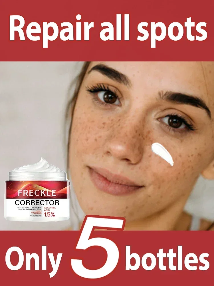 Niacinamide Dark Spots Remover Serum Freckle Whitening Moisture Powerful Removal Black Dot Melasma Chloasma Face Skin Care Cream
Niacinamide Dark Spots Remover Serum Freckle Whitening Moisture Powerful Removal Black Dot Melasma Chloasma Face Skin Care Cream