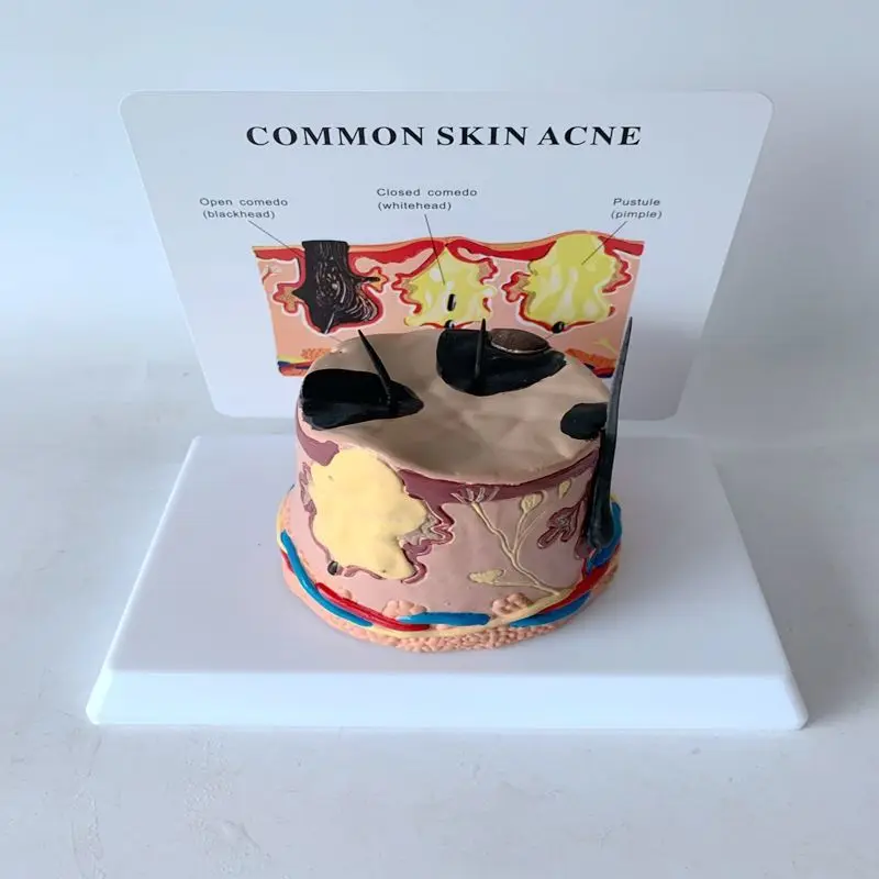 Увеличенная анатомическая модель, обучающая структура ткани кожи человека, красота, трехмерный рост волос, фолікулы для волос
Увеличенная анатомическая модель, обучающая структура ткани кожи человека, красота, трехмерный рост волос, фолікулы для волос