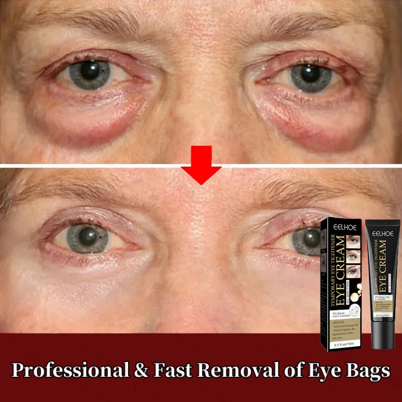 Anti-Wrinkle Eye Cream Remove Eye Bags Dark Circles Anti Aging Lifting Firming Smooth Skin Care Moisturizing Beauty Health
Anti-Wrinkle Eye Cream Remove Eye Bags Dark Circles Anti Aging Lifting Firming Smooth Skin Care Moisturizing Beauty Health