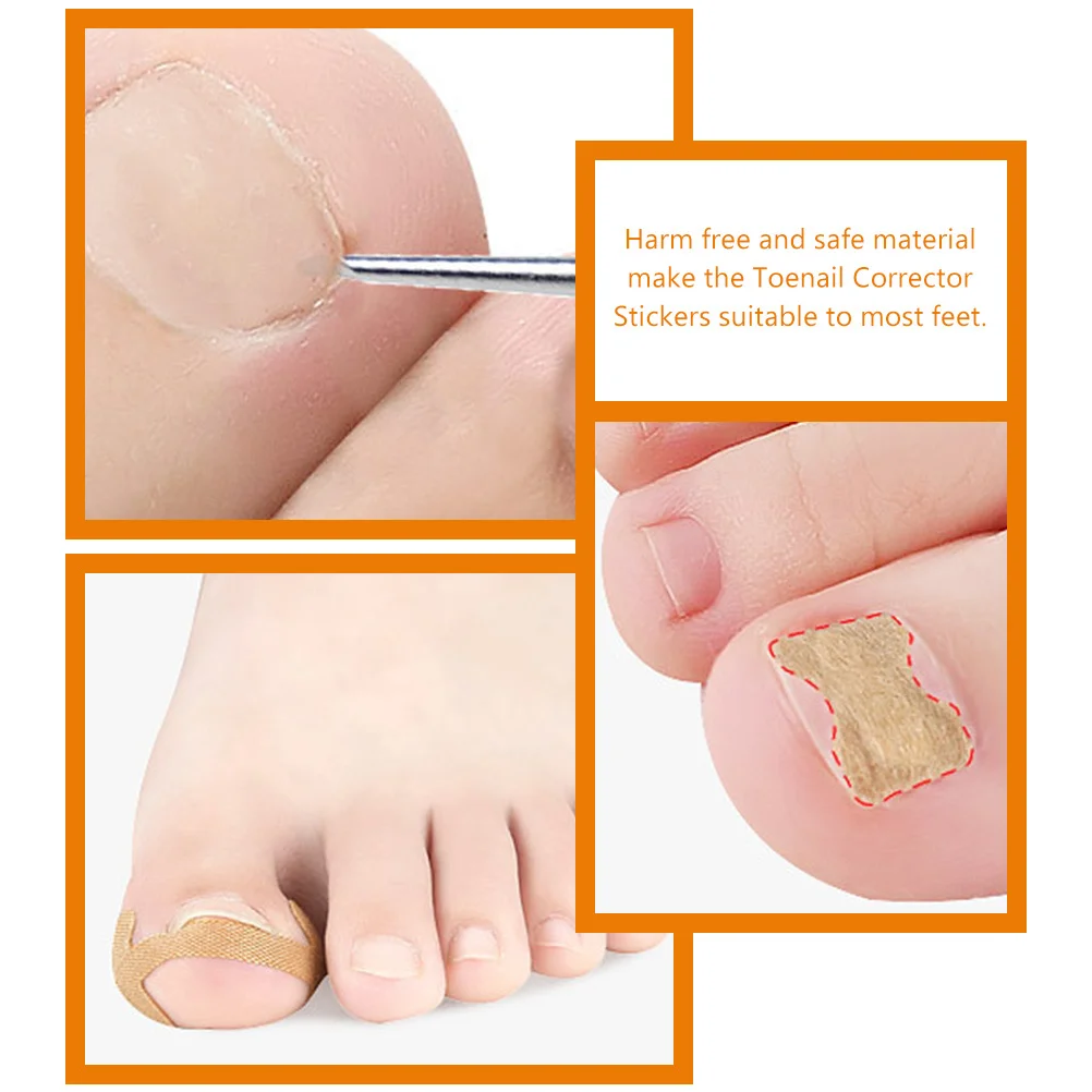 1Set Toenail Corrector Patches Ingrown Nail Correction Stickers Nail Tool Foot Care Ingrown Toenail Repair Treatment Safe
1Set Toenail Corrector Patches Ingrown Nail Correction Stickers Nail Tool Foot Care Ingrown Toenail Repair Treatment Safe