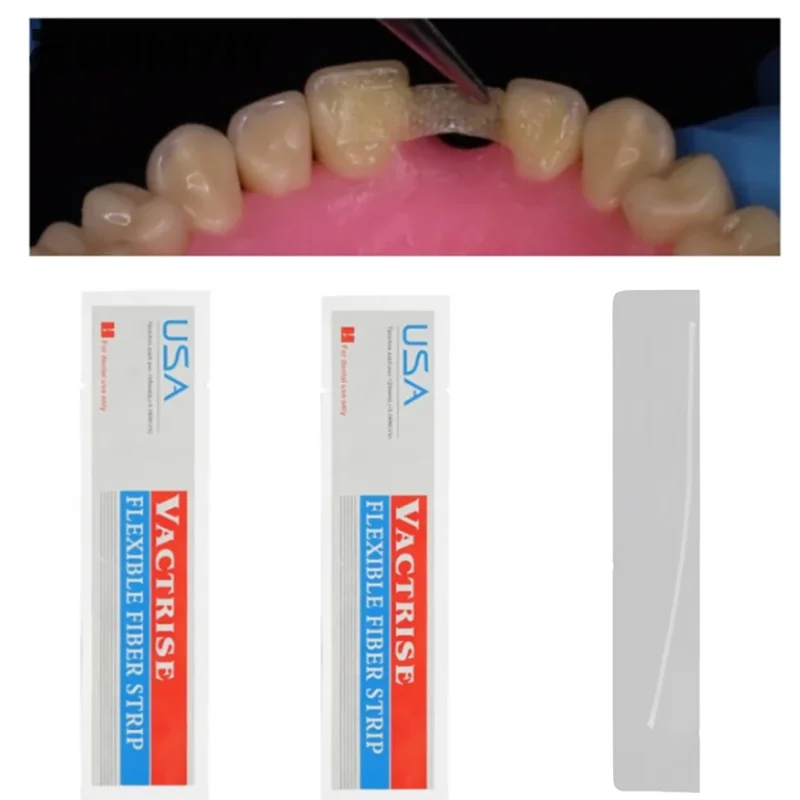 1PCS/Box Dental Material Flexible Fiber Strip Glass Splint Loose Tooth Fixation Strips Light Cure Bonding Orthodontic Retainers
1PCS/Box Dental Material Flexible Fiber Strip Glass Splint Loose Tooth Fixation Strips Light Cure Bonding Orthodontic Retainers