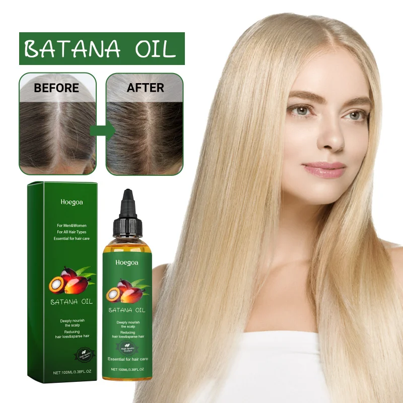 Pure Batana Hair Oil - Nourishes Scalp, Strengthens Hair Roots & Adds Shine For Fuller Looking Healthy Hair Growth
Pure Batana Hair Oil - Nourishes Scalp, Strengthens Hair Roots & Adds Shine For Fuller Looking Healthy Hair Growth