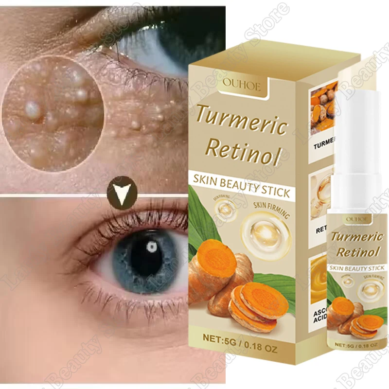 Fat Granules Removal Eye Cream Stick Anti-Puffiness Firming Anti Inflammatory Fade Fine Line Repair Skin Barrier Eye Skin Care
Fat Granules Removal Eye Cream Stick Anti-Puffiness Firming Anti Inflammatory Fade Fine Line Repair Skin Barrier Eye Skin Care