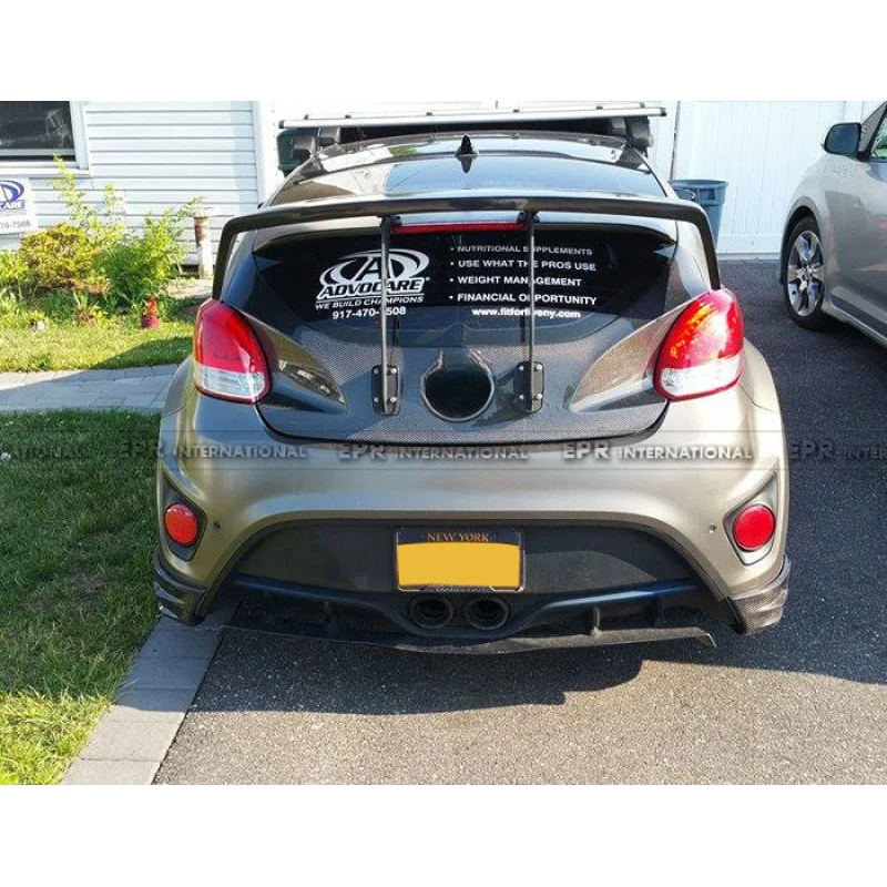 Suitable for Hyundai Veloster Carbon Fiber Modification Parts NEFD Model Bumper Rear Lip Large Corner Guards
Suitable for Hyundai Veloster Carbon Fiber Modification Parts NEFD Model Bumper Rear Lip Large Corner Guards