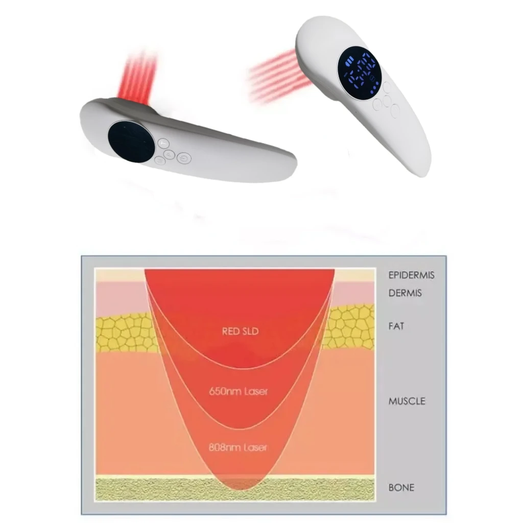 14x650nm + 3x808nm 880m Cold Laser Red Light Therapy Laser Physiotherapy Machine Device for Pain Relief Wound Medical Healthcare
14x650nm + 3x808nm 880m Cold Laser Red Light Therapy Laser Physiotherapy Machine Device for Pain Relief Wound Medical Healthcare