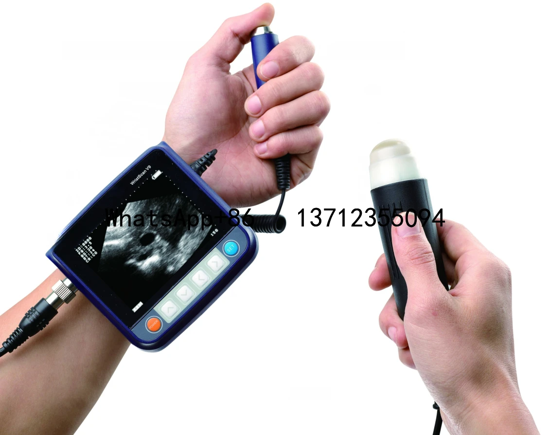 MSLVU29 Lightweight Veterinary Medical Diagnosis Wrist Ultrasound Machine Electric Power Source Small-Sized Metal Plastic
MSLVU29 Lightweight Veterinary Medical Diagnosis Wrist Ultrasound Machine Electric Power Source Small-Sized Metal Plastic