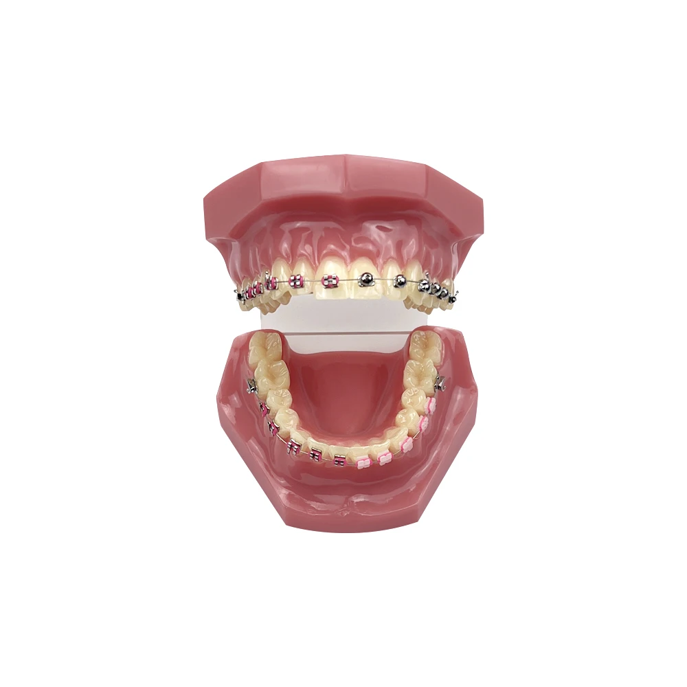 Dental Teeth Model Orthodontic Model With Brackets 1/4 Spherical Self-Locking For Teaching Studying Dentist-Patient Education
Dental Teeth Model Orthodontic Model With Brackets 1/4 Spherical Self-Locking For Teaching Studying Dentist-Patient Education
