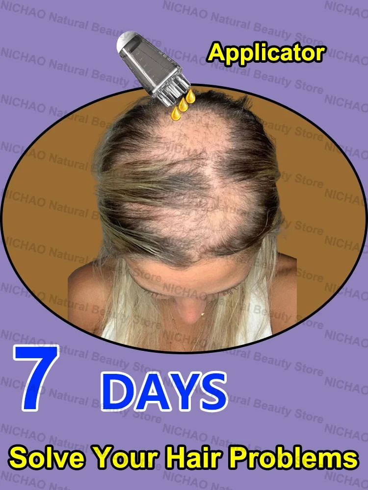 7 Days Fast Hair Growth Essential Loss Regrowth Treatment Strengthens Hair Nourishes Scalp Light Weight Non Greasy
7 Days Fast Hair Growth Essential Loss Regrowth Treatment Strengthens Hair Nourishes Scalp Light Weight Non Greasy