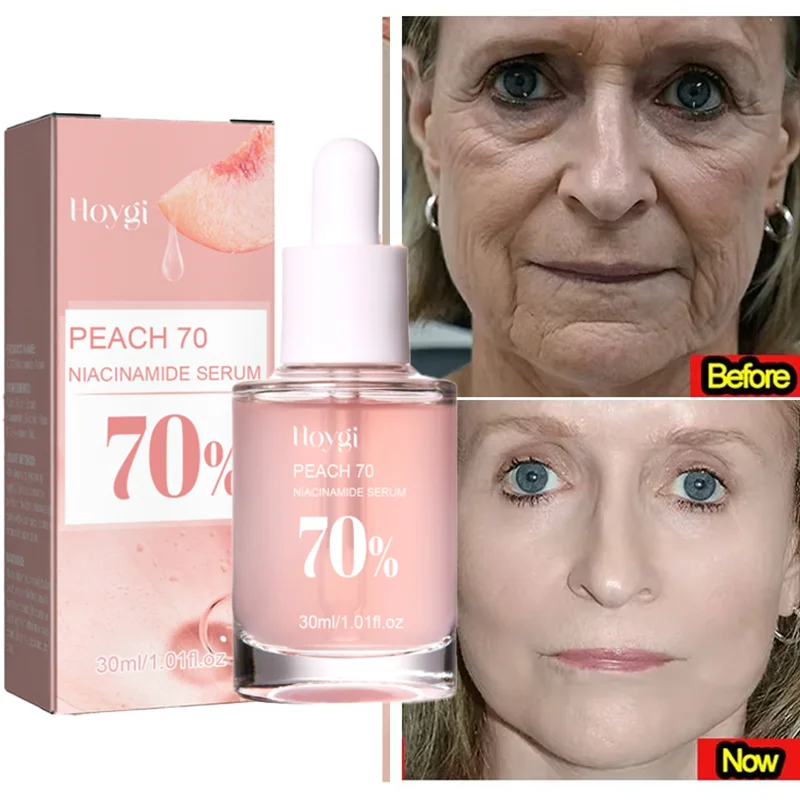 Niacinamide Anti-Wrinkle Essence Tightening Firming Dispelling Fade Fine Lines Moisturizing Serum Skin Antioxidant Protection
Niacinamide Anti-Wrinkle Essence Tightening Firming Dispelling Fade Fine Lines Moisturizing Serum Skin Antioxidant Protection