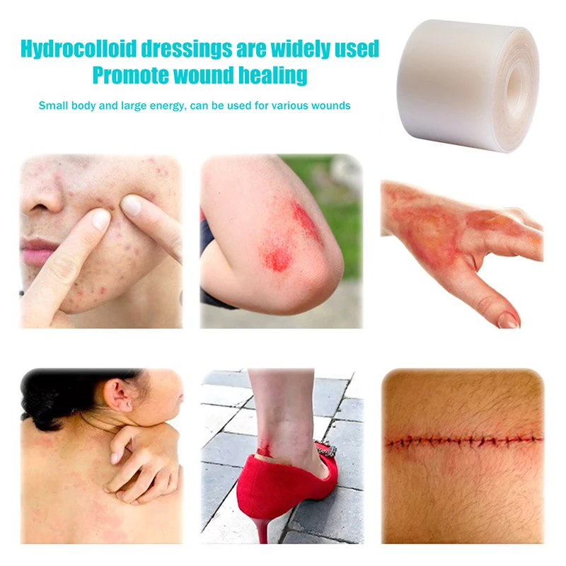 Hydrocolloid Roll Wound Care Hydrocolloid Dressing Bed Sore Bandages Invisible Heel Patch Waterproof Acne Sticker Healing Pad 
Hydrocolloid Roll Wound Care Hydrocolloid Dressing Bed Sore Bandages Invisible Heel Patch Waterproof Acne Sticker Healing Pad