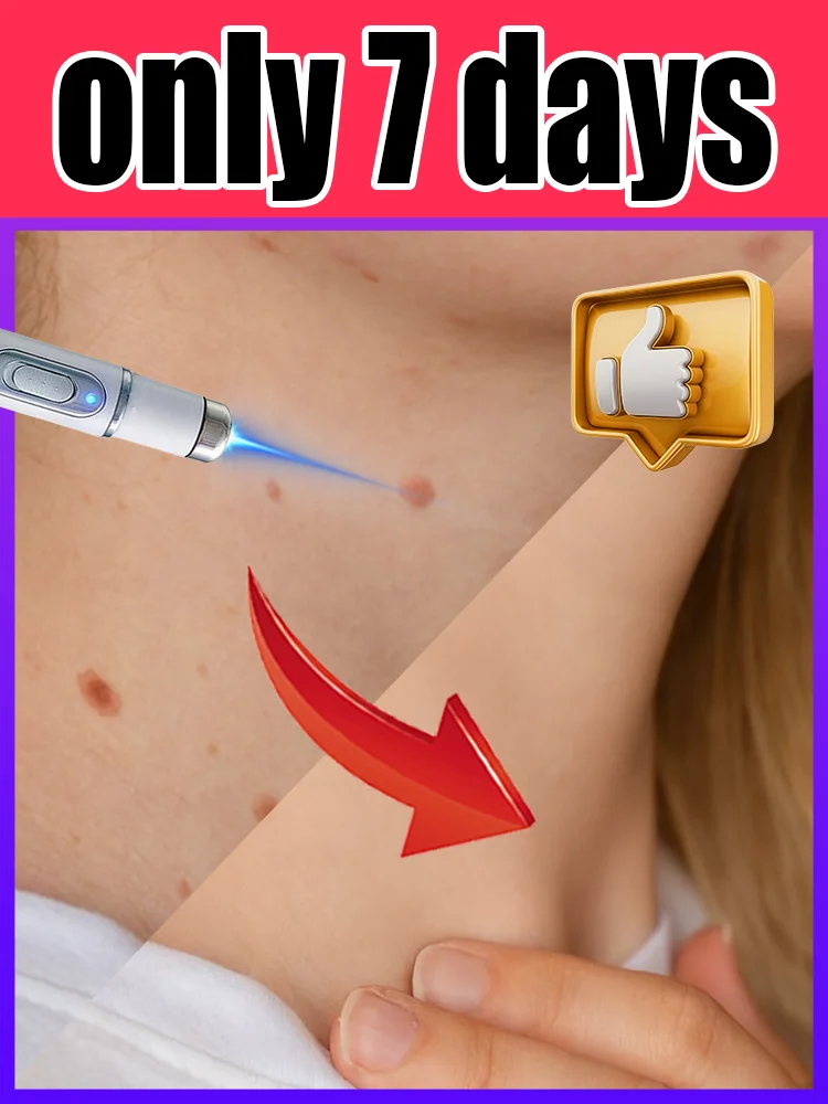 Pʀᴏғᴇssɪᴏɴᴀʟ ʙʟᴜᴇ ʟɪɢʜᴛ ᴡᴀʀᴛ ʀᴇᴍᴏᴠᴀʟ ᴘᴇɴ:Eғғᴇᴄᴛɪᴠᴇ ғᴏʀ Bᴏᴅʏ Wᴀʀᴛ Rᴇᴍᴏᴠᴀʟ
Pʀᴏғᴇssɪᴏɴᴀʟ ʙʟᴜᴇ ʟɪɢʜᴛ ᴡᴀʀᴛ ʀᴇᴍᴏᴠᴀʟ ᴘᴇɴ:Eғғᴇᴄᴛɪᴠᴇ ғᴏʀ Bᴏᴅʏ Wᴀʀᴛ Rᴇᴍᴏᴠᴀʟ