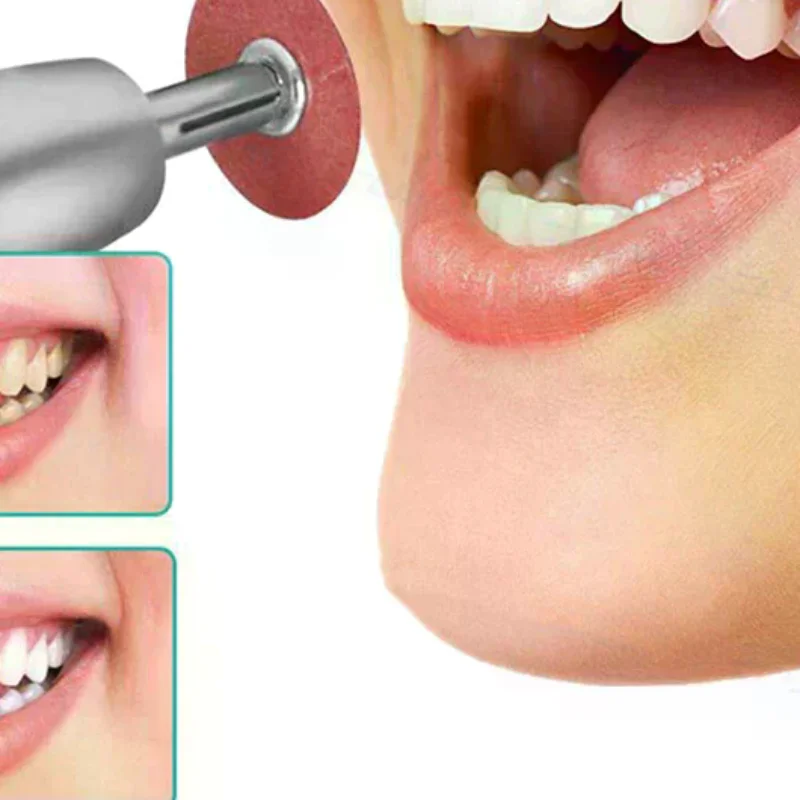 50pcs Dental Finishing and Polishing Discs Dentist Composite Metals Autoclavable Lab Tools Dentist Polishing Materials
50pcs Dental Finishing and Polishing Discs Dentist Composite Metals Autoclavable Lab Tools Dentist Polishing Materials