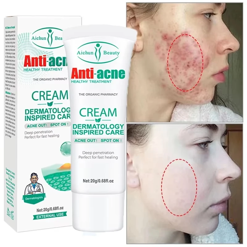 Tea Tree Acne Removal Face Cream Pore Shrink Serum Oil Control Whitening Repair Pimple Anti-acne Repair Damage Skin Care Product
Tea Tree Acne Removal Face Cream Pore Shrink Serum Oil Control Whitening Repair Pimple Anti-acne Repair Damage Skin Care Product